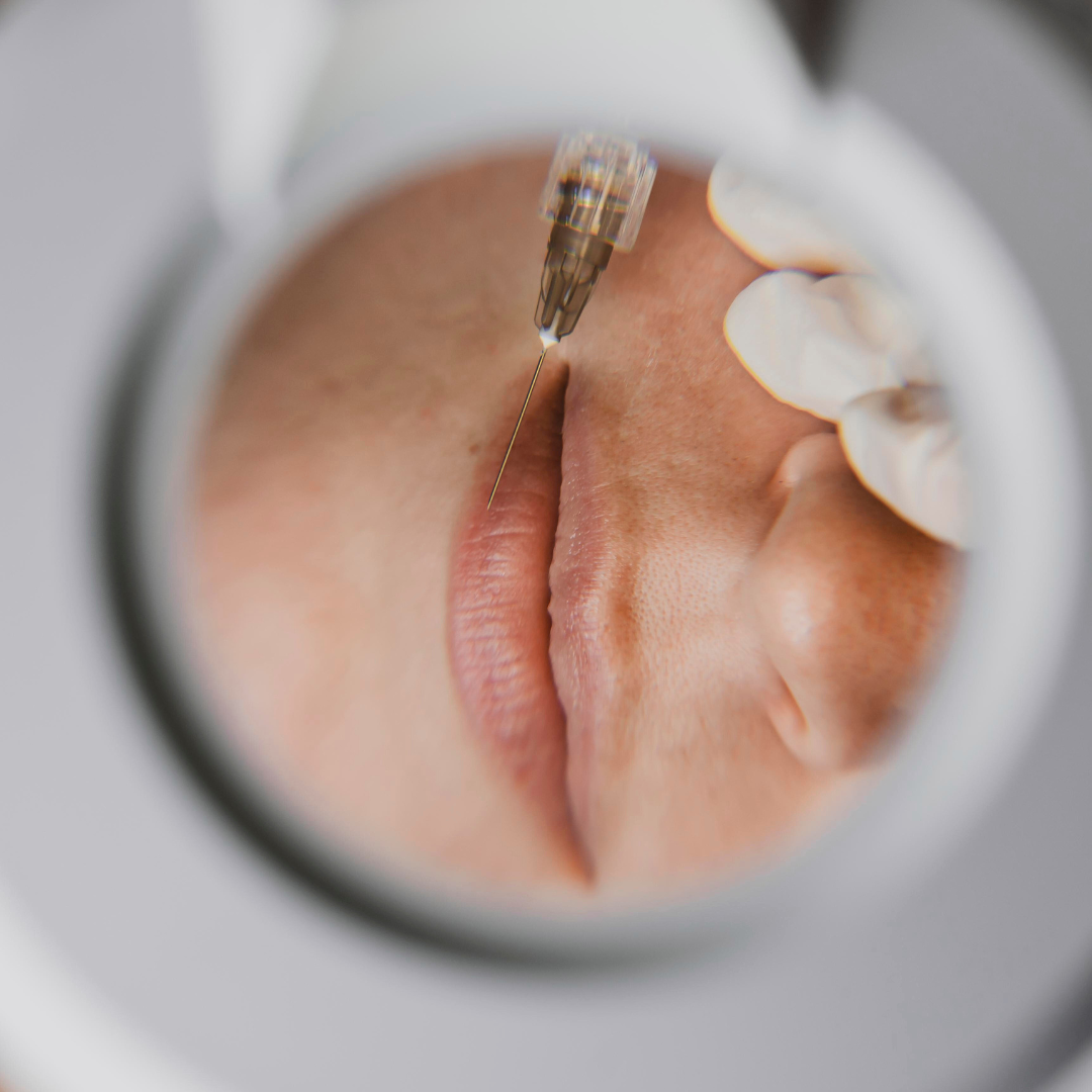 Esztétikai kezelések: természetes szépség modern megoldásokkal